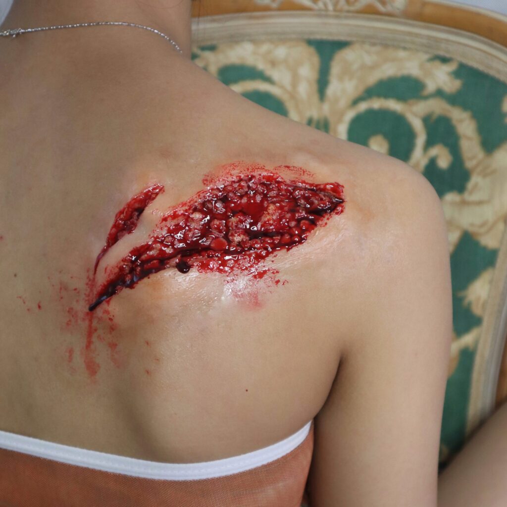Wounds & Scars