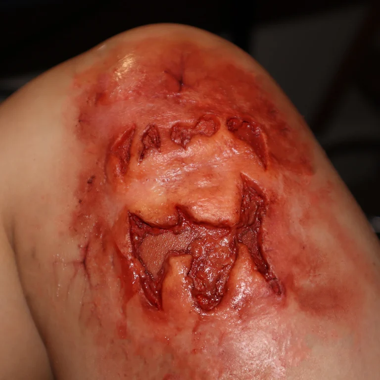 Zombie Bite
