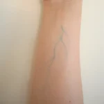 Veins