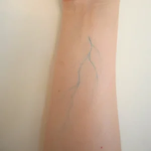 Veins