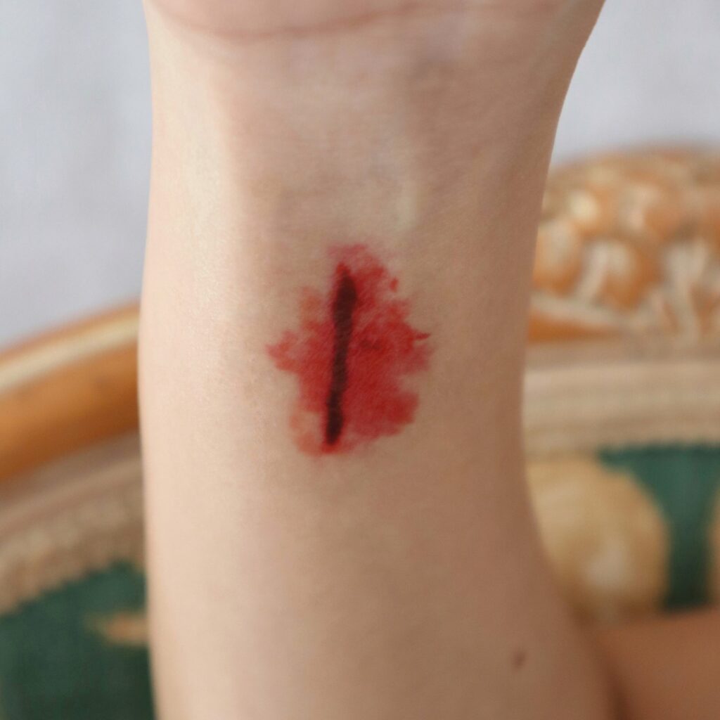 Wounds & Scars