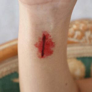 Bleeding Stab Wound