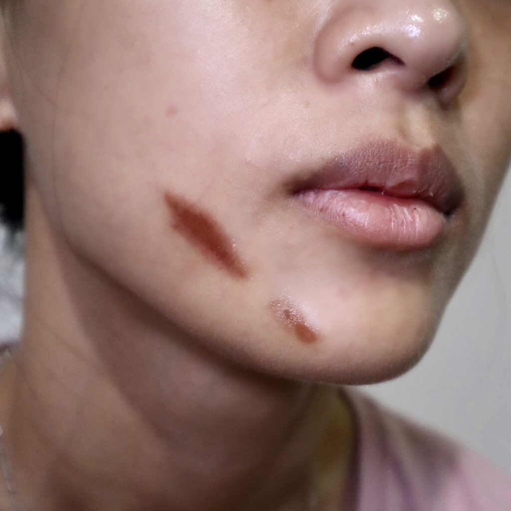 Wounds & Scars