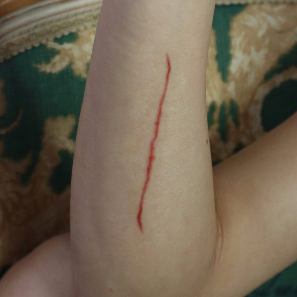 Wounds & Scars
