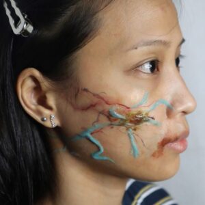 Vein