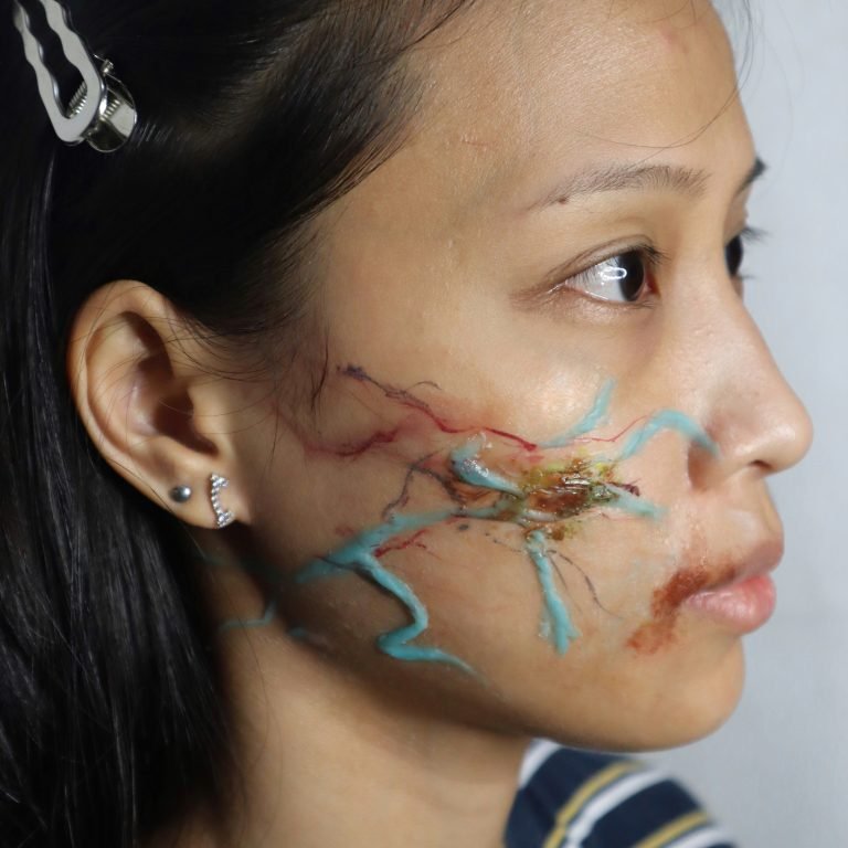 Vein