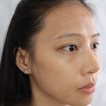 Pointy Nose