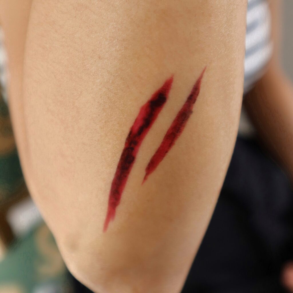 Wounds & Scars
