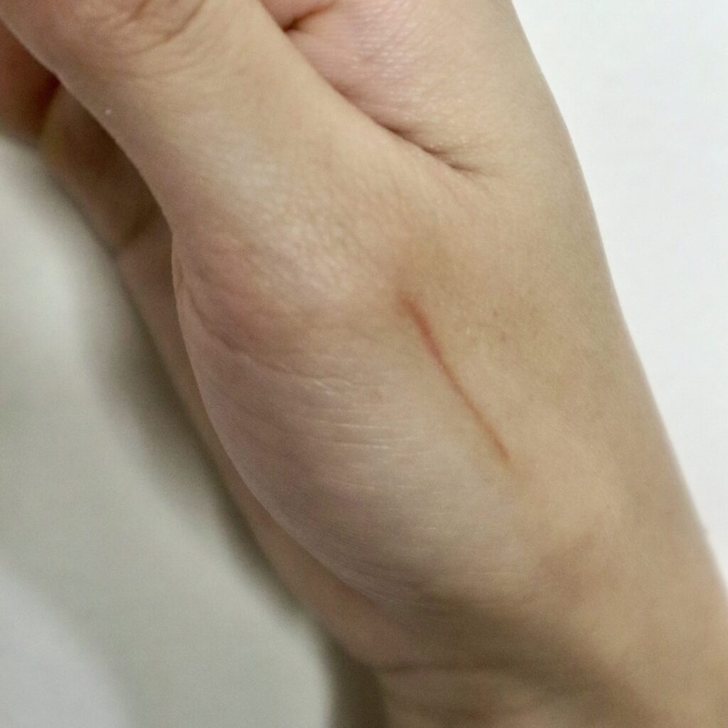 Wounds & Scars