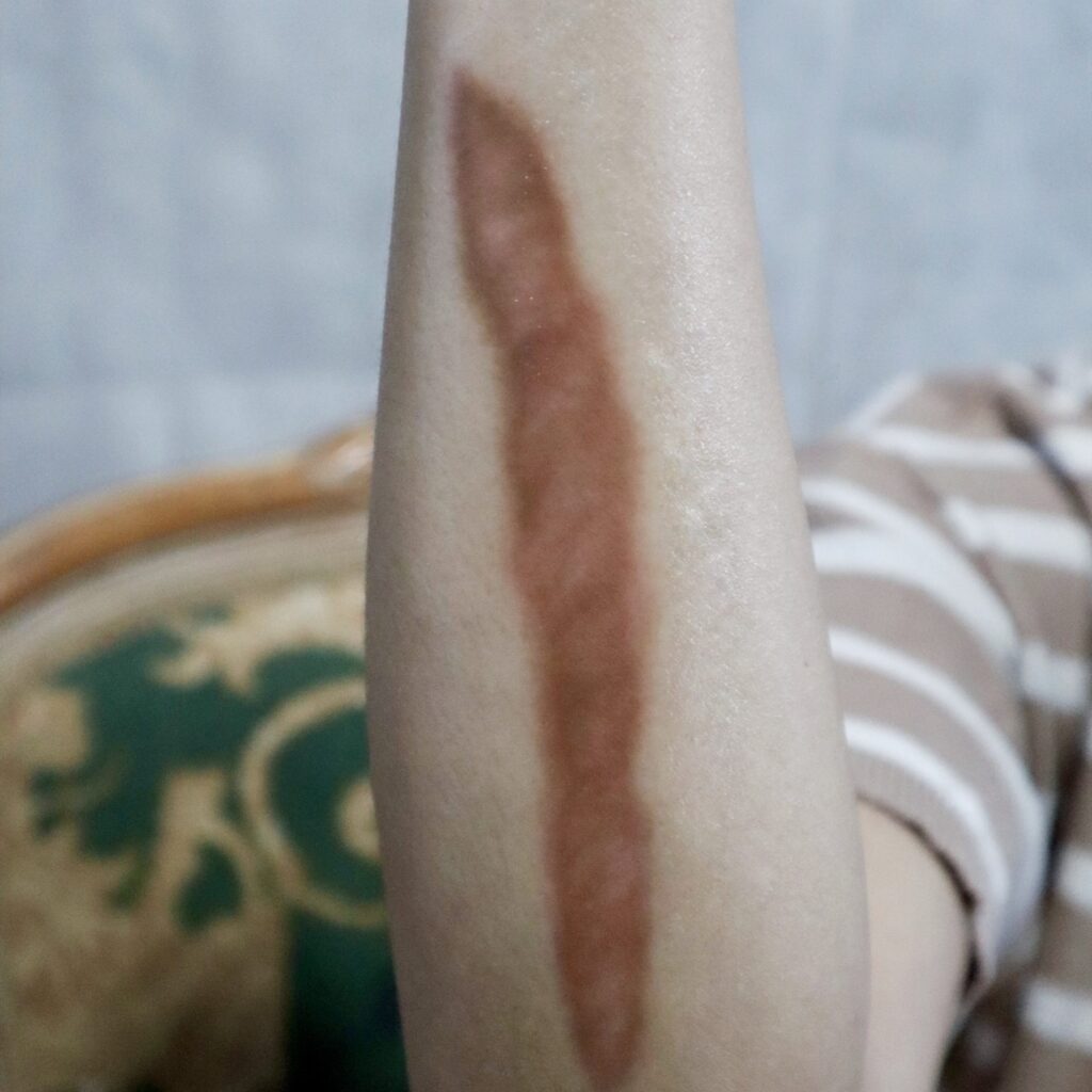 Wounds & Scars
