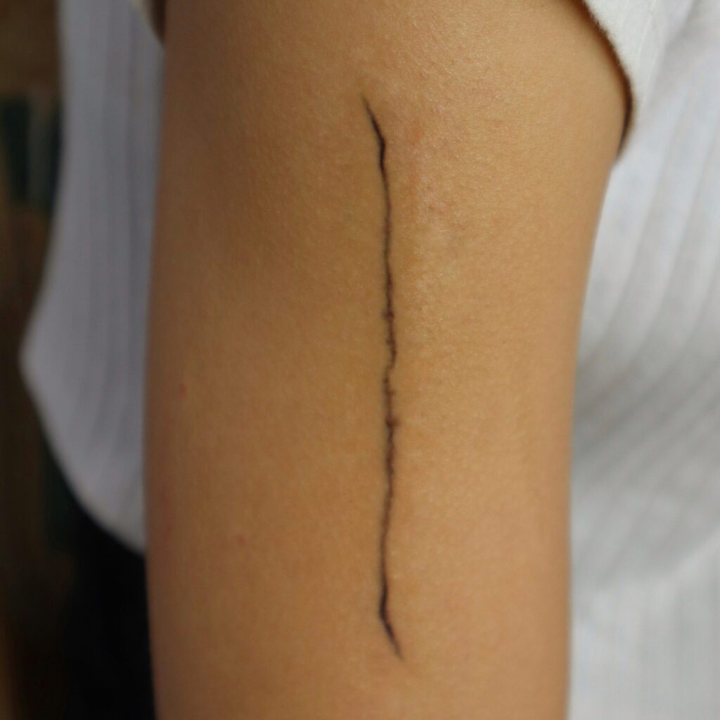 Wounds & Scars
