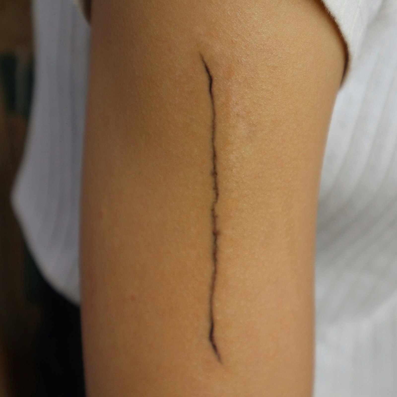 Poisoned Cut