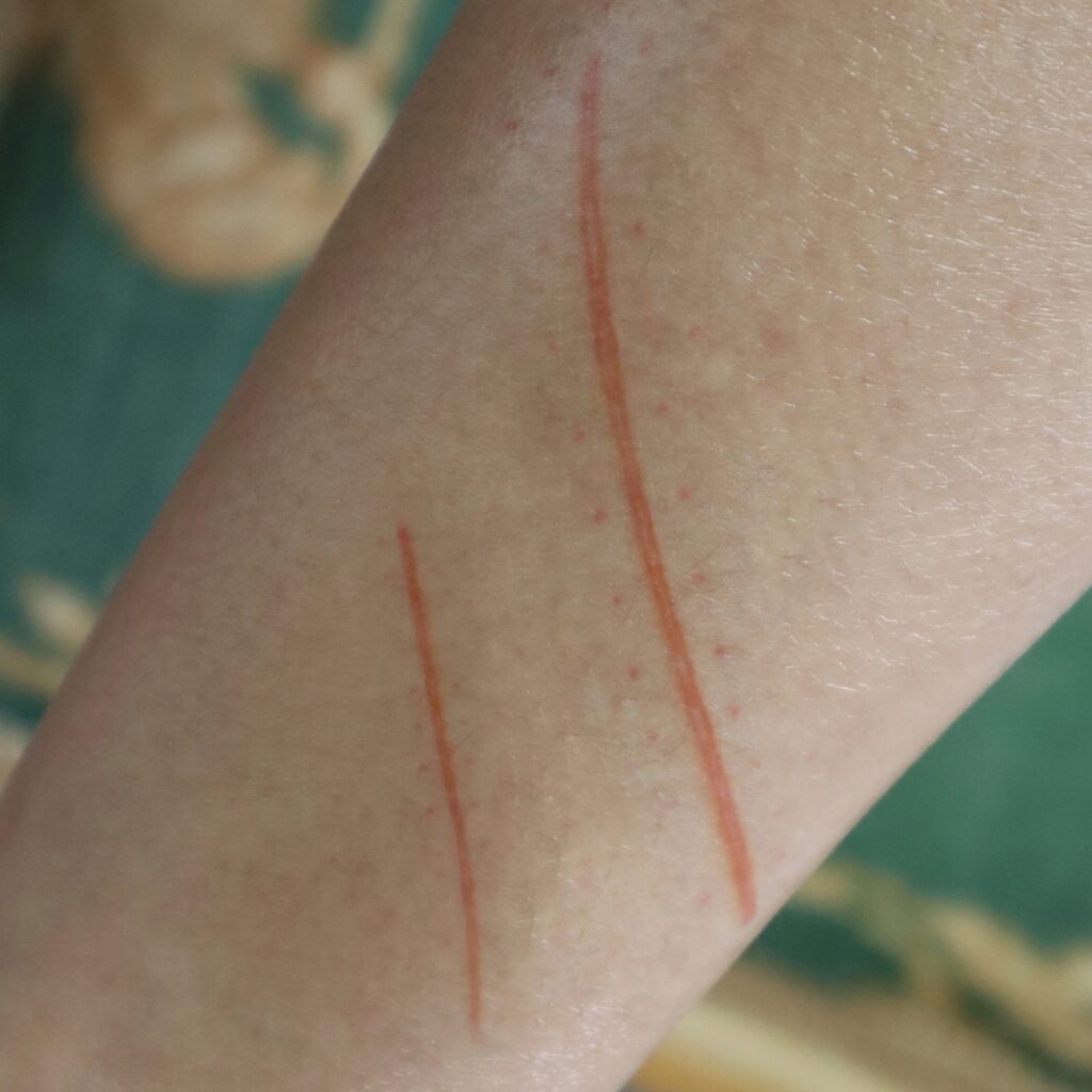 Wounds & Scars