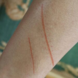 Fresh / Healing Stitch Cut