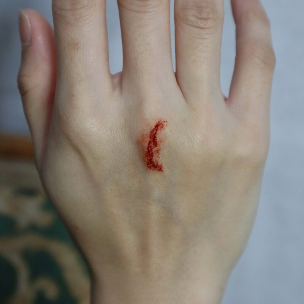 Wounds & Scars
