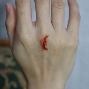 Facial Scarring Silicone Prosthetic (2.2 x 1.6 cm) – SFX & Cosplay (7 Skin Tones)