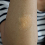Skin Texture