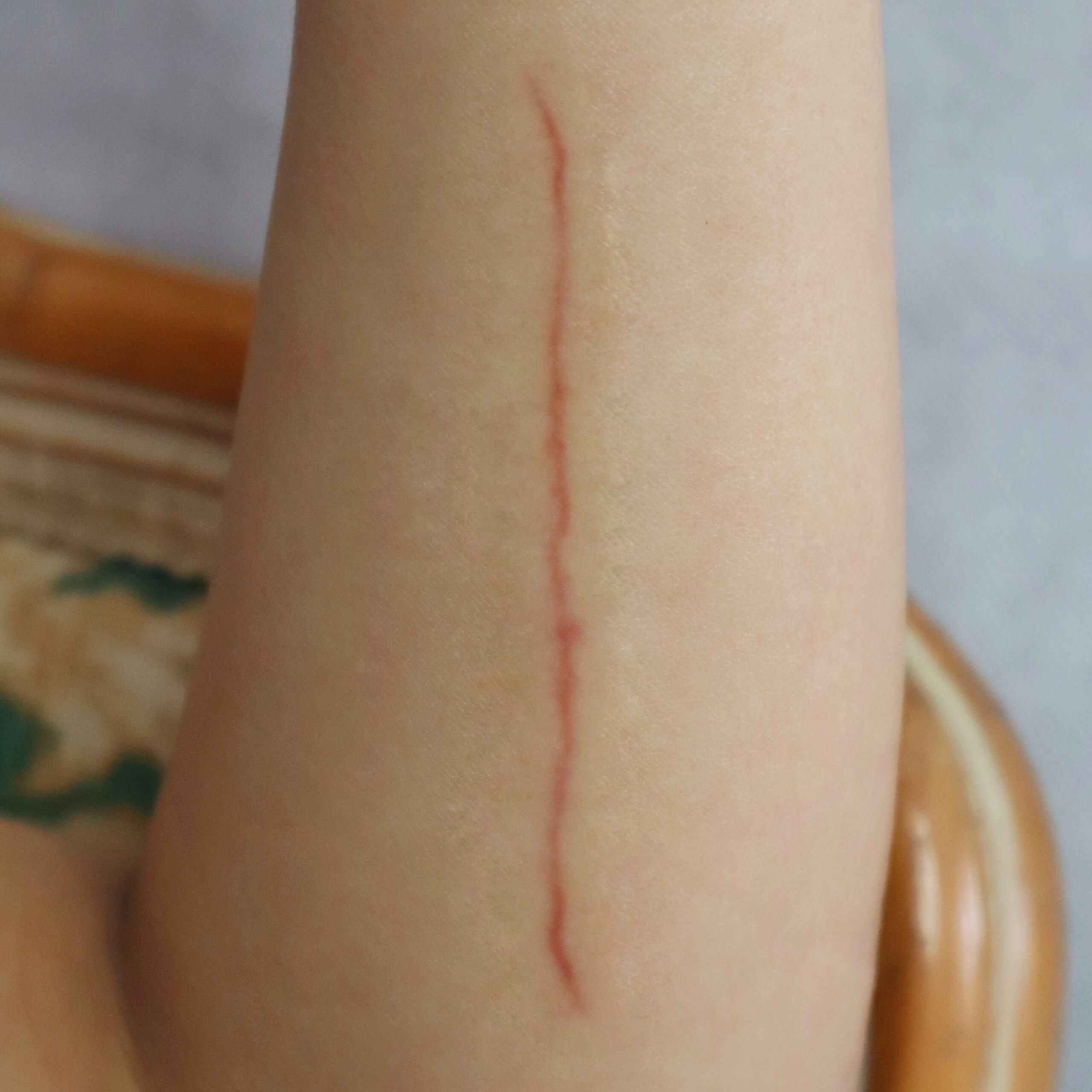 Healing / Fresh Medium Cut SFX Wound โ Special Effects Body Art - Image 4