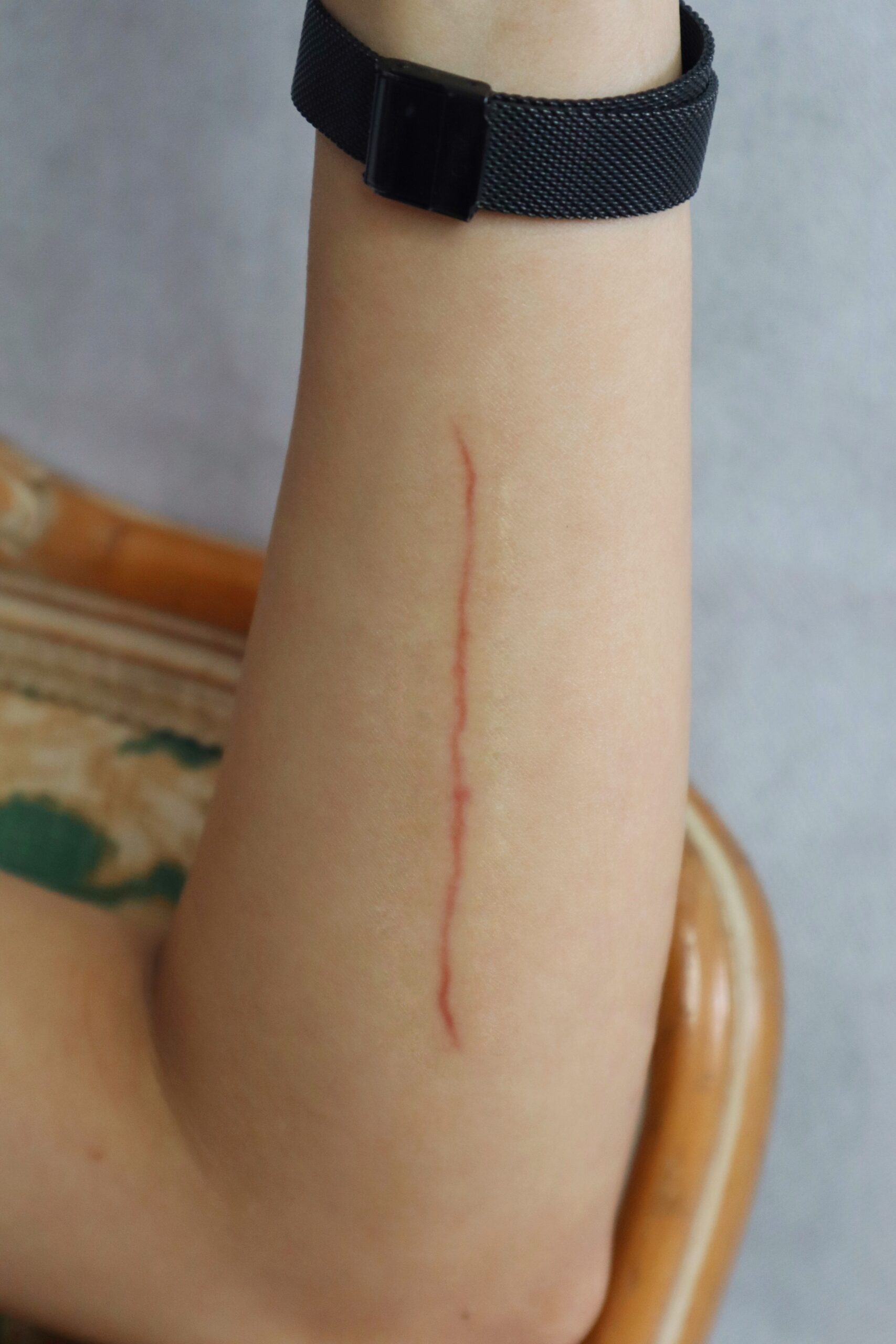 Healing / Fresh Medium Cut SFX Wound โ Special Effects Body Art - Image 3