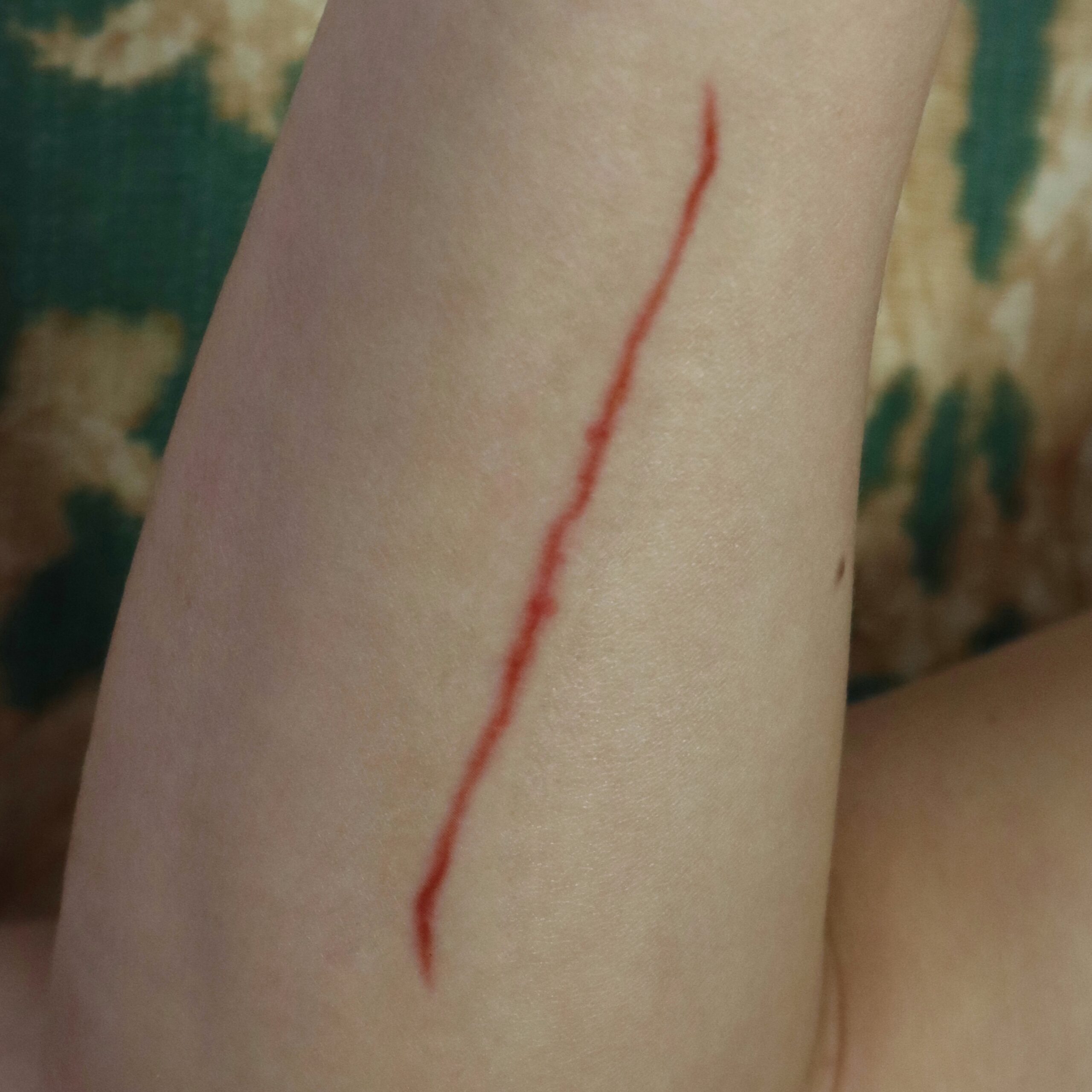 Healing / Fresh Medium Cut SFX Wound โ Special Effects Body Art - Image 2