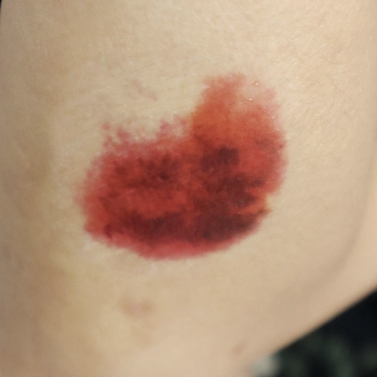 Fresh / Healing Bruise SFX โ Special Effects Body Art - Image 3