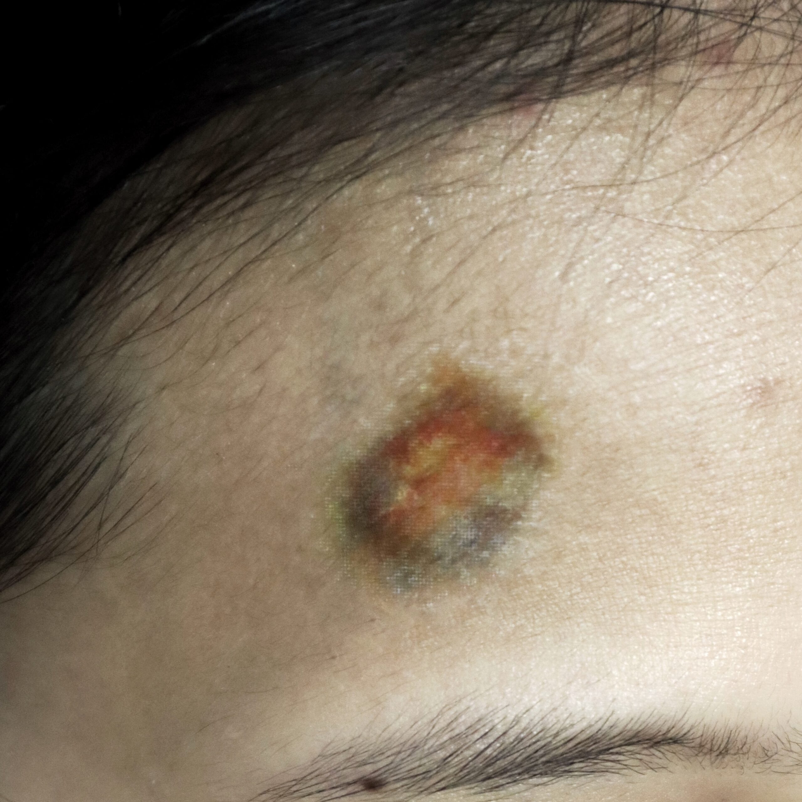 Small Bruise Temporary Tattoo โ SFX Bruise Effect - Image 2