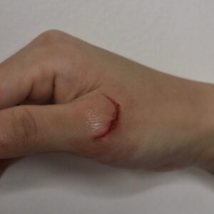 Facial Scarring Silicone Prosthetic (2.2 x 1.6 cm) – SFX & Cosplay (7 Skin Tones)
