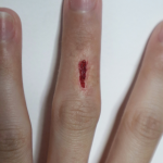 Small Scar