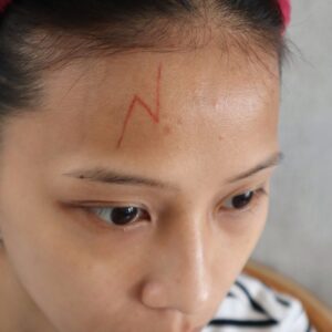 Lightning Scar
