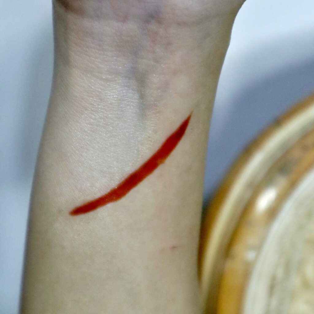 Wounds & Scars