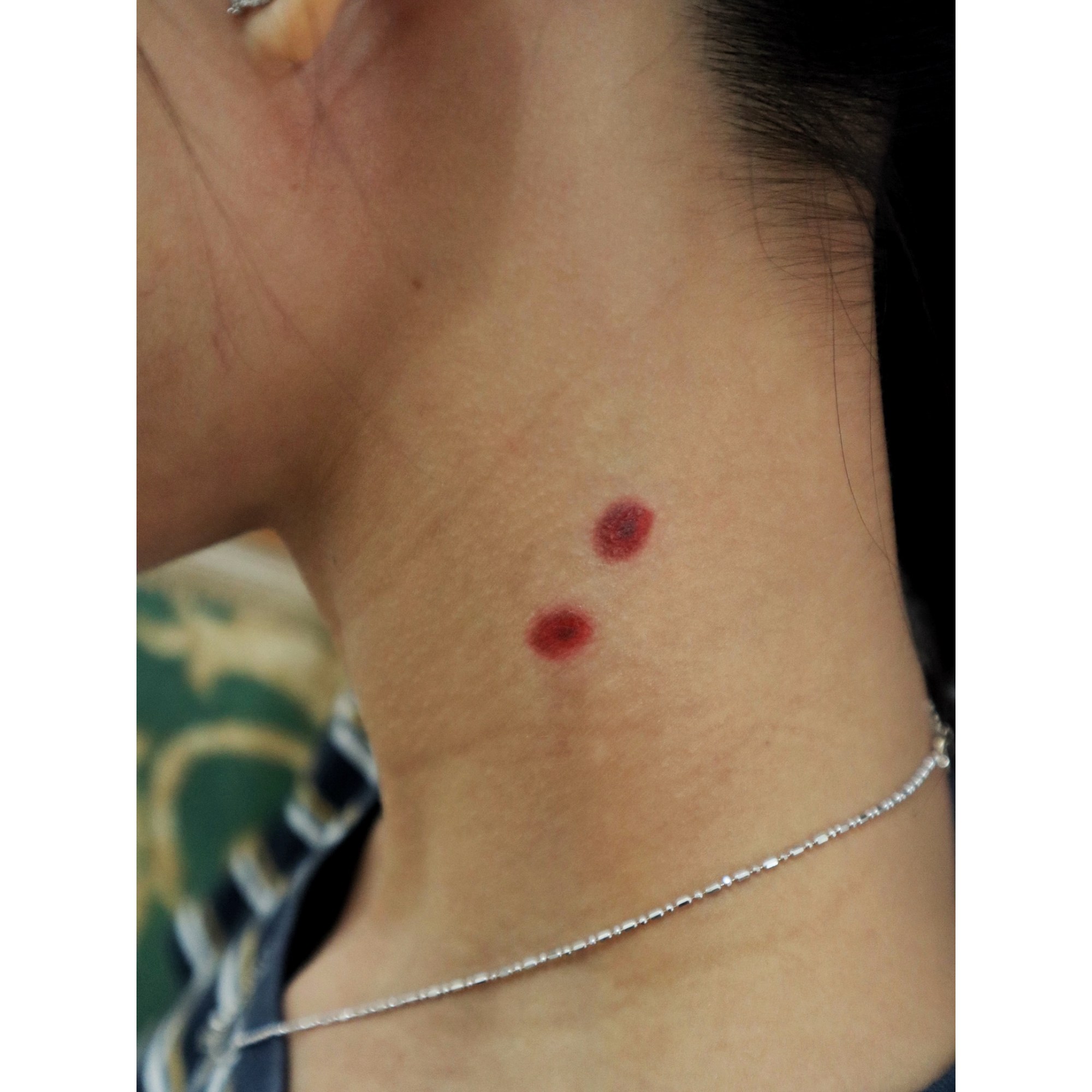 Vampire Bite Wound Temporary Tattoo – SFX Wound Effect