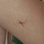 Veins