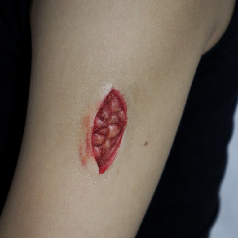 Wounds & Scars