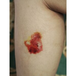 Fresh Bruise Temporary Tattoo – SFX Bruise Effect