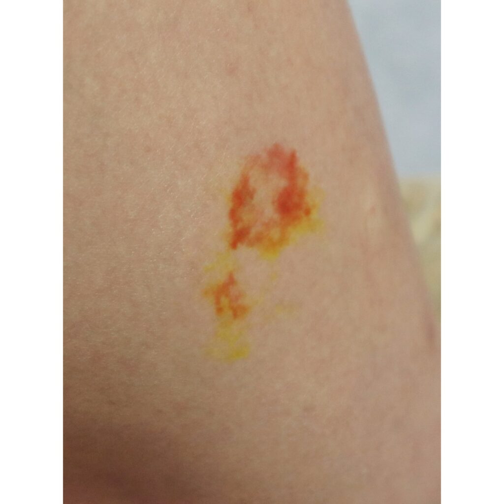 Wound Tattoos