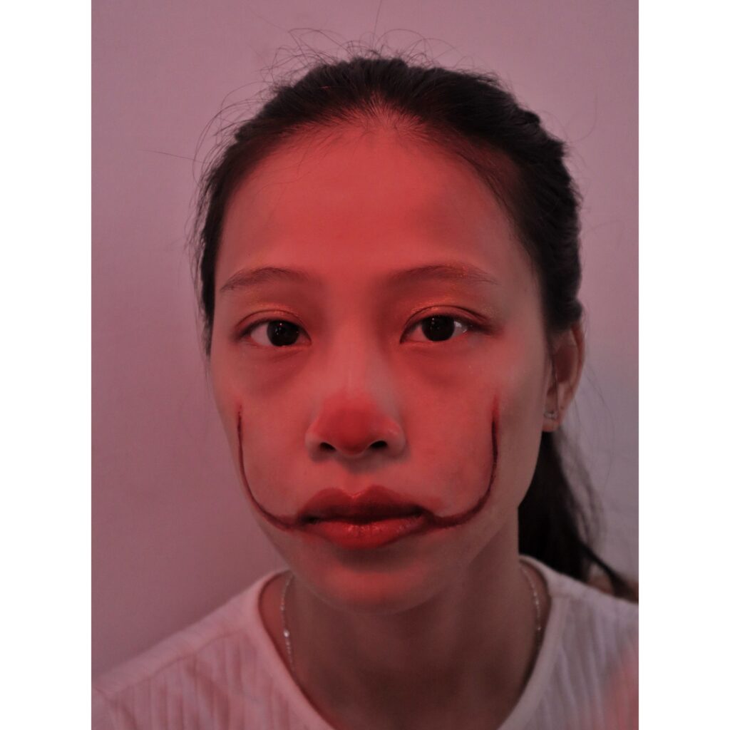 Prosthetics