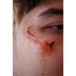 Facial Scarring Silicone Prosthetic (2.2 x 5.2 cm) – SFX & Cosplay (7 Skin Tones)