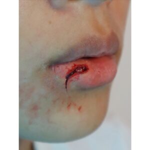 Facial Scarring Silicone Prosthetic (1 x 2 cm) – SFX & Cosplay (7 Skin Tones)