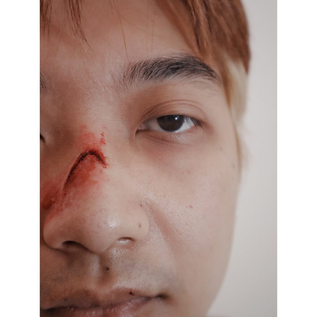 Prosthetics