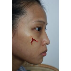 Facial Scarring Silicone Prosthetic (3.3 x 3 cm) – SFX & Cosplay (7 Skin Tones)