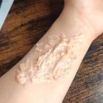 Burn Scar