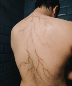 Big Vein