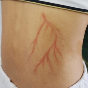 Lichtenberg Vein Temporary Tattoo – SFX Body Art