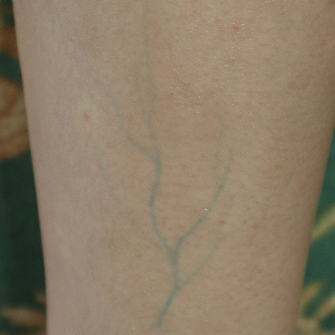 Blue Veins Temporary Tattoo – SFX Body Art - Image 2