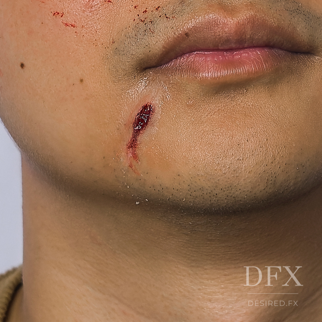 Facial Scarring Silicone Prosthetic (1.2 x 2.7 cm) โ SFX & Cosplay (7 Skin Tones)