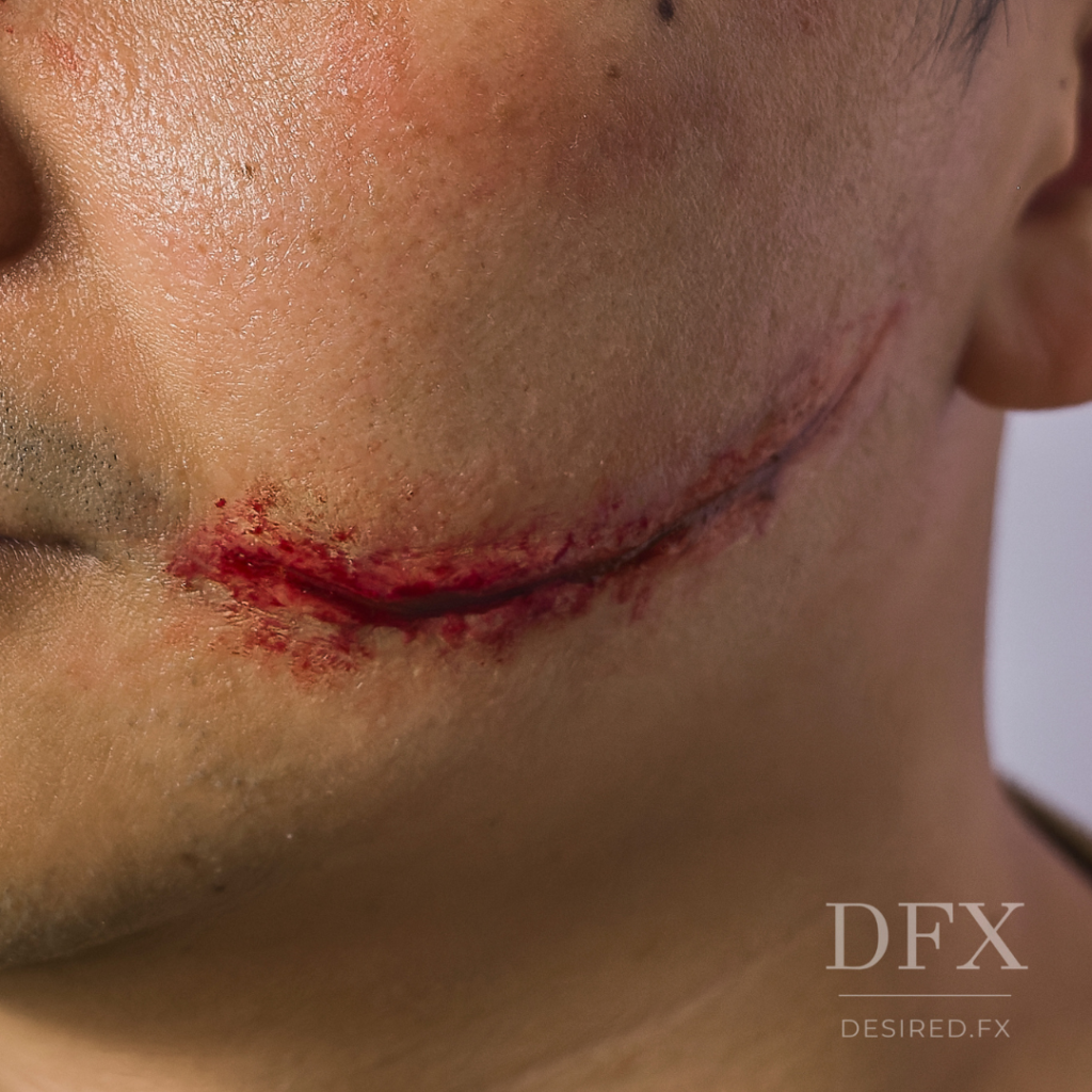 Prosthetics