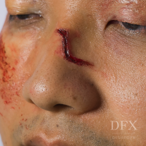 Facial Scarring Silicone Prosthetic (1.5 x 3.5 cm) โ SFX & Cosplay (7 Skin Tones)