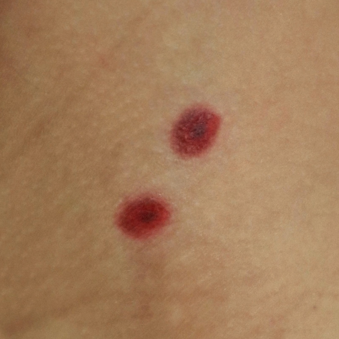 Vampire Bite Wound Temporary Tattoo – SFX Wound Effect - Image 2