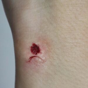 Small Scar Silicone Prosthetic (1.6 x 1.5 cm) – SFX & Cosplay (7 Skin Tones)